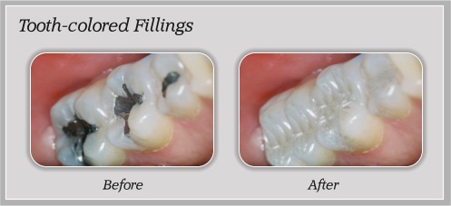 Before and After Dental Treatment