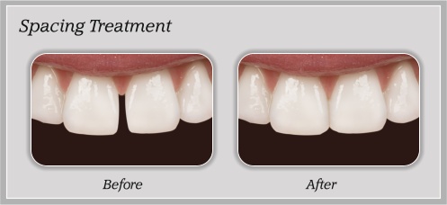 Before and After Dental Treatment