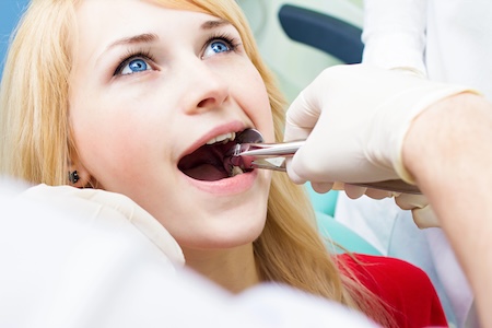 Extractions